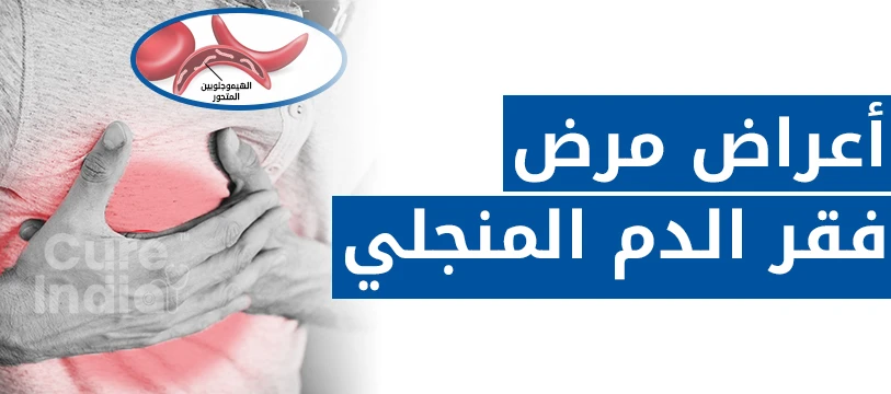 أعراض الأنيميا المنجلية